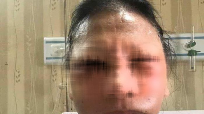 Akibat Adu Mulut, Andriansyah Aniaya Aini Hingga Luka Lebam